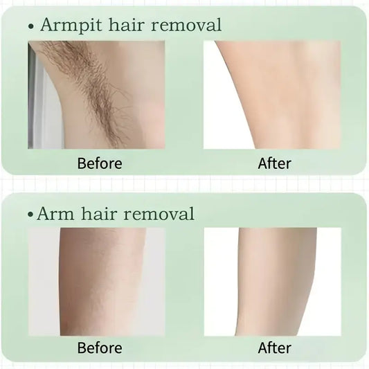 Depiladora Eléctrica USB para Cuerpo Completo