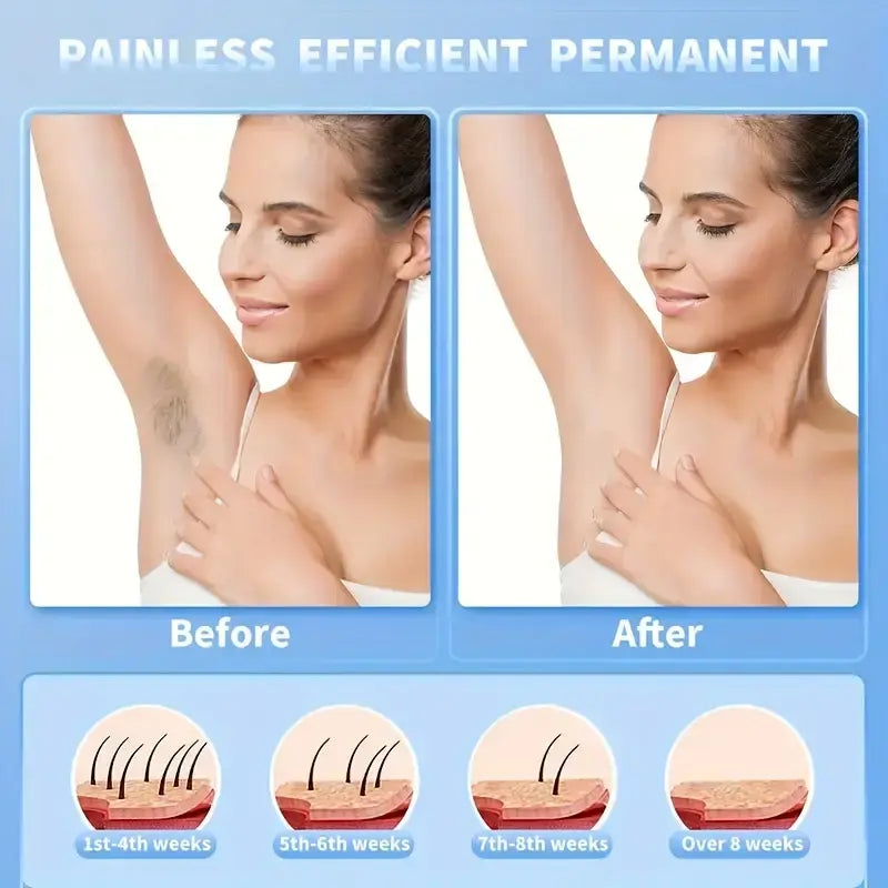 Depiladora Eléctrica USB para Cuerpo Completo